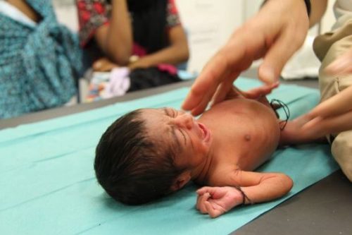 child born with low birth rate