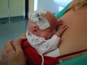 What Are the Implications of Low Birth Weight?