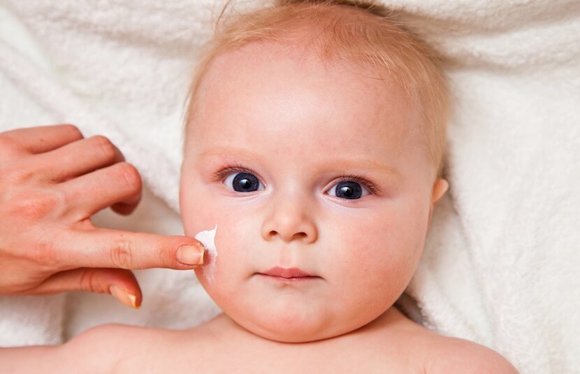 Child with atopic dermatiti