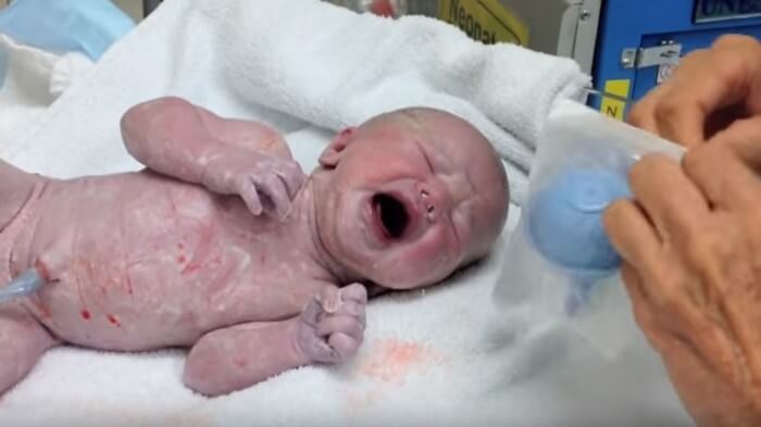 Newborn crying in hospital bed