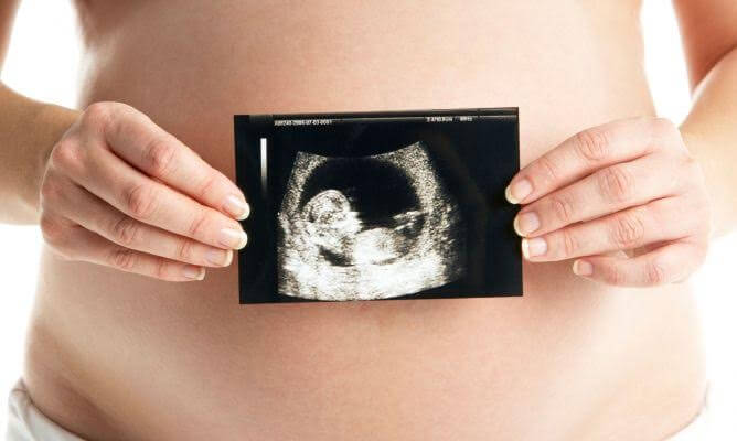 Woman holding ultra sound results