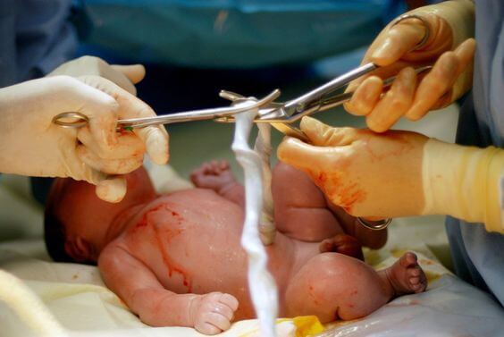 childbirth dictionary umbilical chord