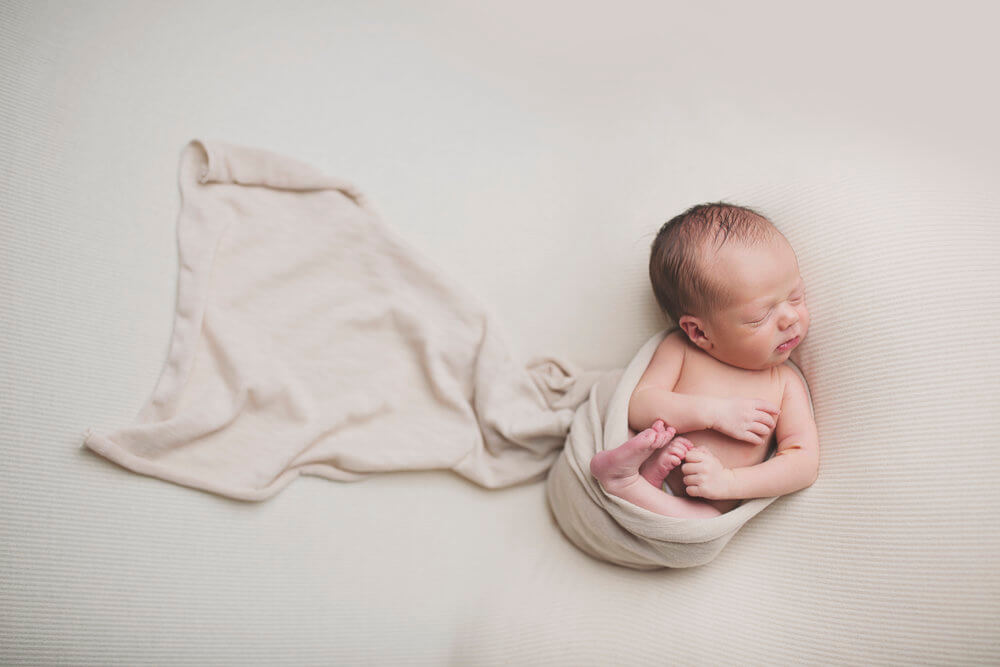 miliaria in babies