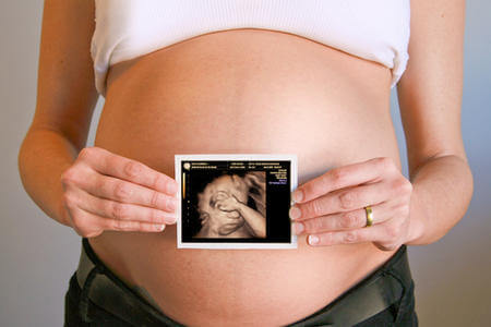 pregnant mom showing pic of ultrasound