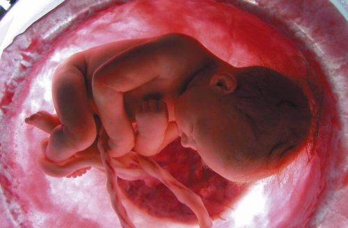 umbilical cord baby in womb