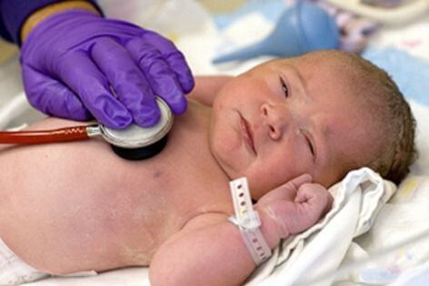 doctor performing the Apgar test on a newborn baby