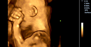 What Your Baby Feels When You Cry From Sadness During Pregnancy