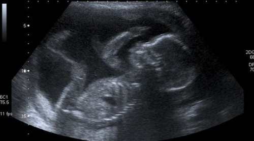 The Coming of New Life