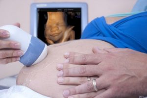 The Coming of New Life: A Mother's Love for Her Unborn Child