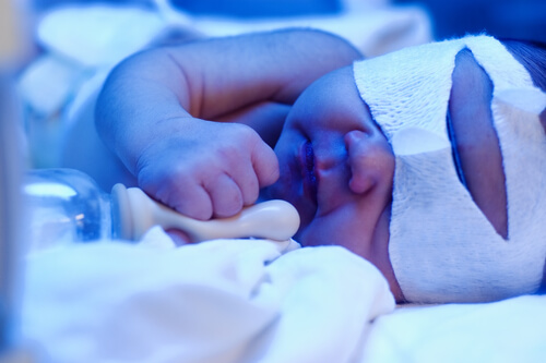 jaundice in healthy newborns