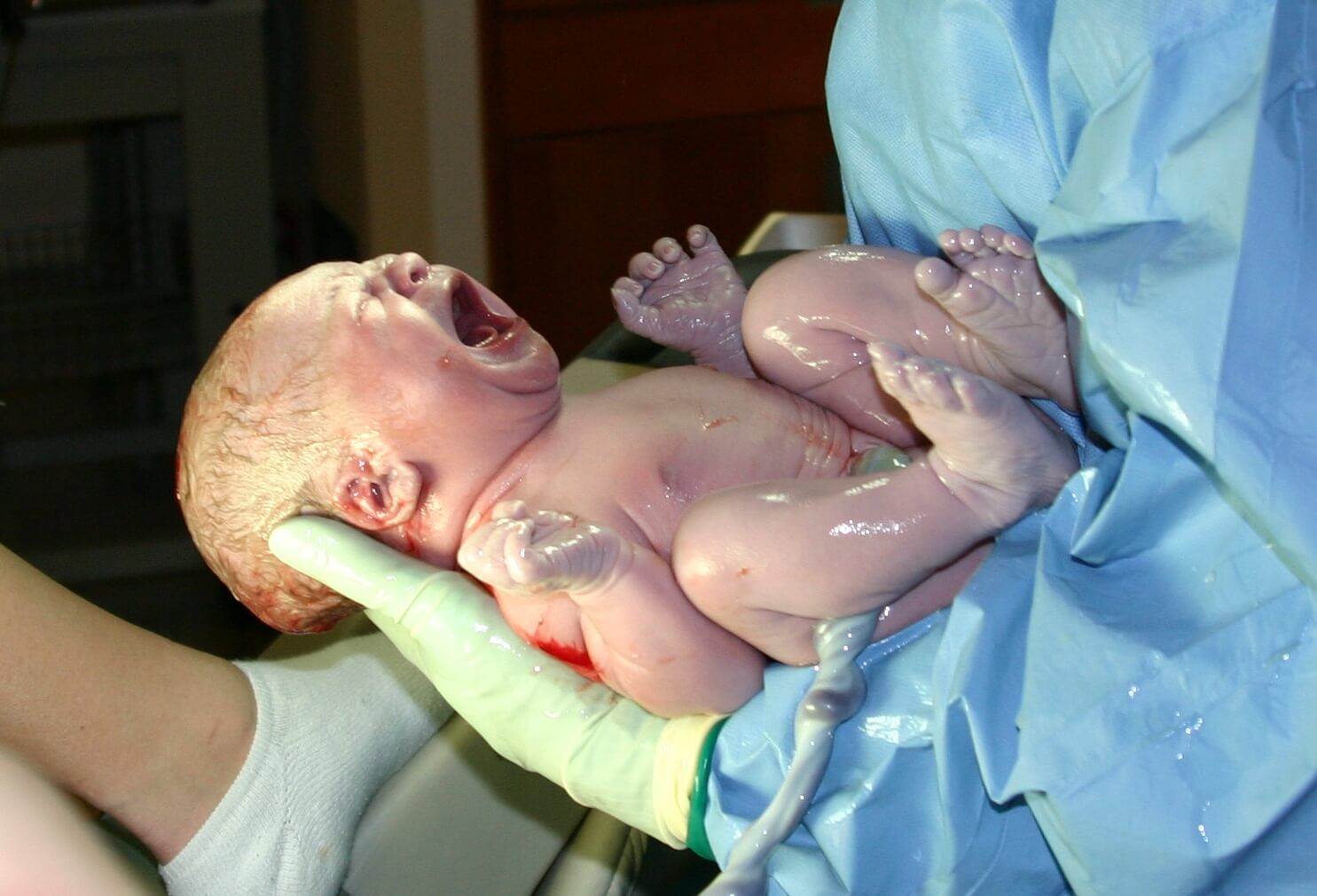 Are you familiar with the 9 different types of childbirth?
