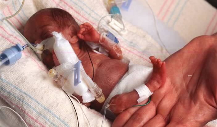 Wonderful News: More and More Extremely Premature Babies Are Surviving