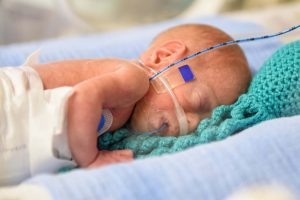 Wonderful News: More and More Extremely Premature Babies Are Surviving