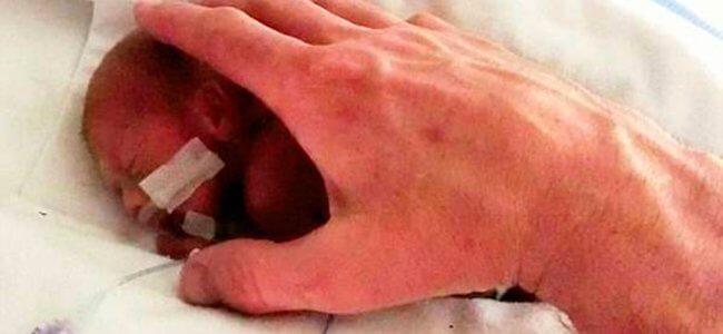 Wonderful News: More and More Extremely Premature Babies Are Surviving