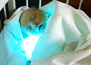 What Is Infant Jaundice And How Is It Treated?
