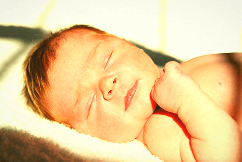 What Is Infant Jaundice And How Is It Treated?