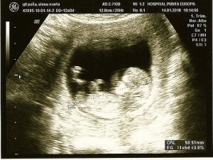 Innovative Techniques To Detect Pregnancy Complications