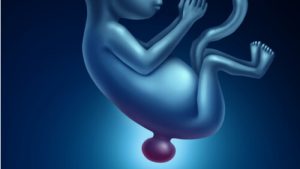 Babies Born with Spina Bifida