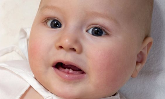 The Possible Complications of Teething