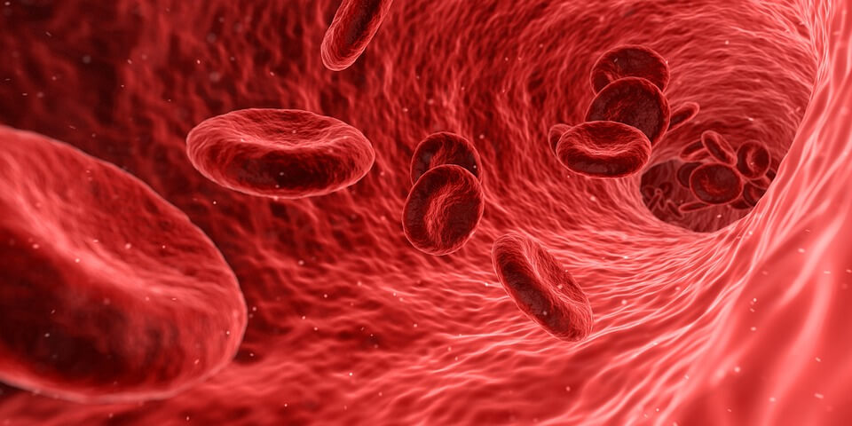 Hughes Syndrome and Spontaneous Abortions