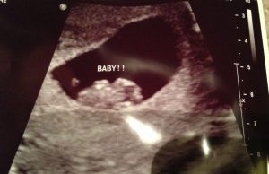 The Ramzi Method to Find Out Your Baby’s Sex