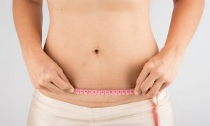 Caring for a Cesarean Scar after Childbirth