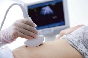 What is Amniotic Band Constriction?