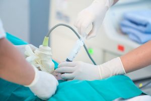 What is Amniocentesis?