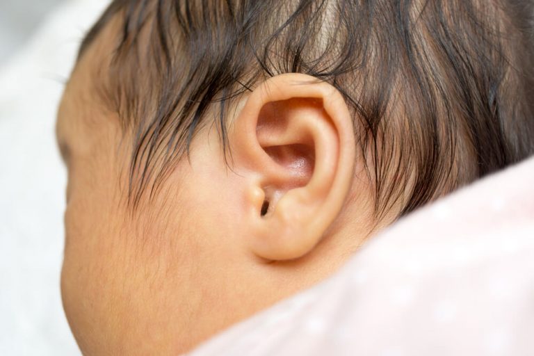 Early Detection of Deafness in Newborns