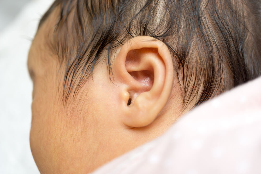 Deafness in Babies: Everything You Need to Know