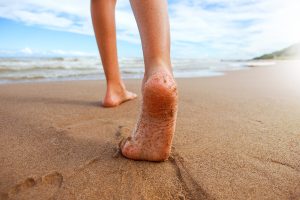 How to Correct Bow Legs in Children