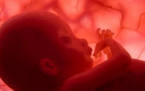 What Are the Risks of Umbilical Cord Prolapse?