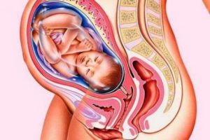 Insufficient Cervix: Risk Factors, Consequences and Treatment