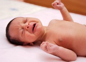 Torticollis in Babies