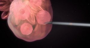 Artificial Insemination: What It Is and How To Get It