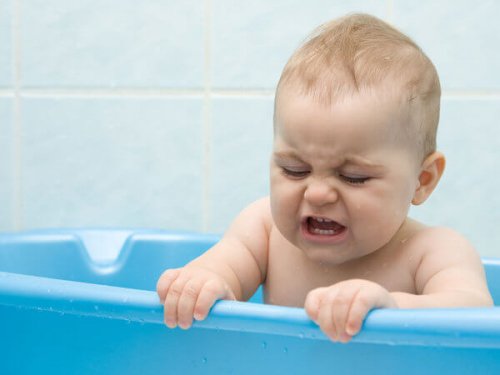 What Is Cradle Cap?