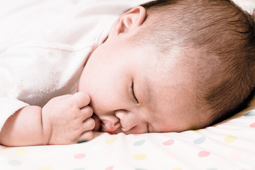 What Is Cradle Cap?