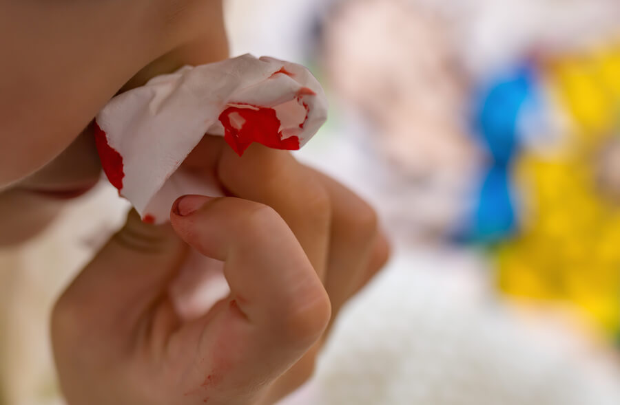 Vomiting Blood: Causes and Treatments