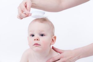 What Is Cradle Cap?