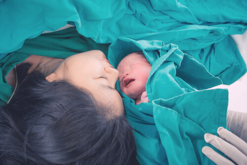 Evolution of the Cesarean Technique