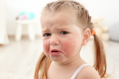 The Most Common Food Allergies in Children