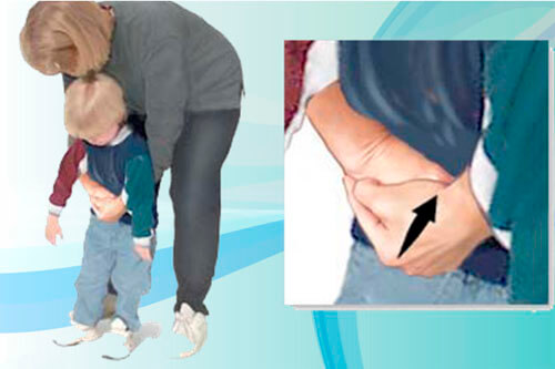 How to Treat Choking in Children