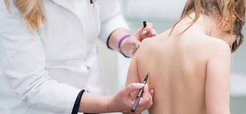 Scoliosis in Children: Everything You Need to Know