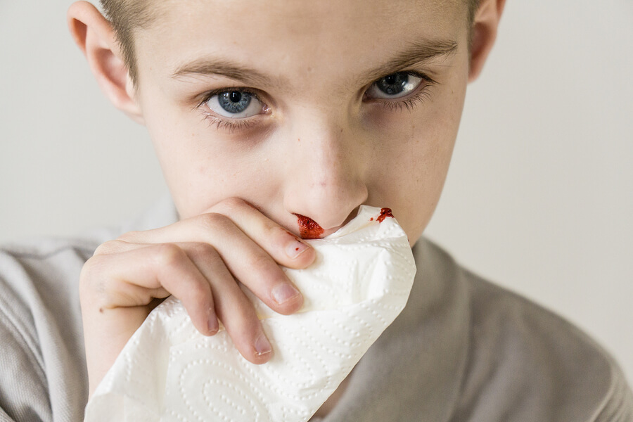 Nosebleeds in Children: Causes and Treatment - You are Mom