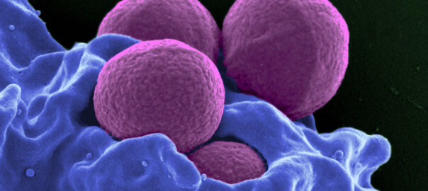 Low Neutrophils in Babies