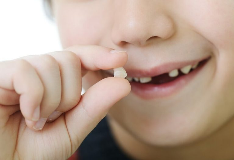 When Do Milk Teeth Fall Out, and When Do Permanent Teeth Come In?