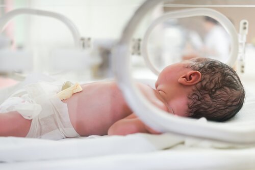 Questions and Answers About Premature Babies