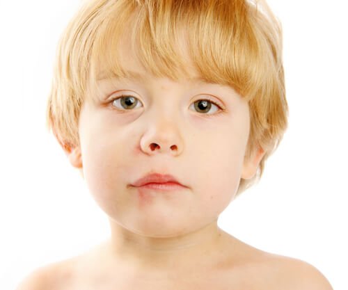 Mouth Sores in Children: Causes and Treatment