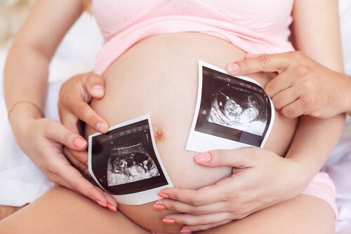 Is It Possible to Choose Your Baby's Sex?