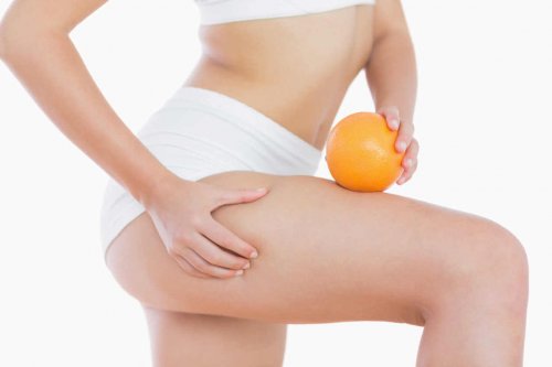 How to Fight Cellulite After Pregnancy